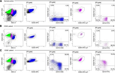 Aberrant myelomonocytic CD56 expression predicts response to cyclosporine therapy in pediatric patients with moderate aplastic anemia